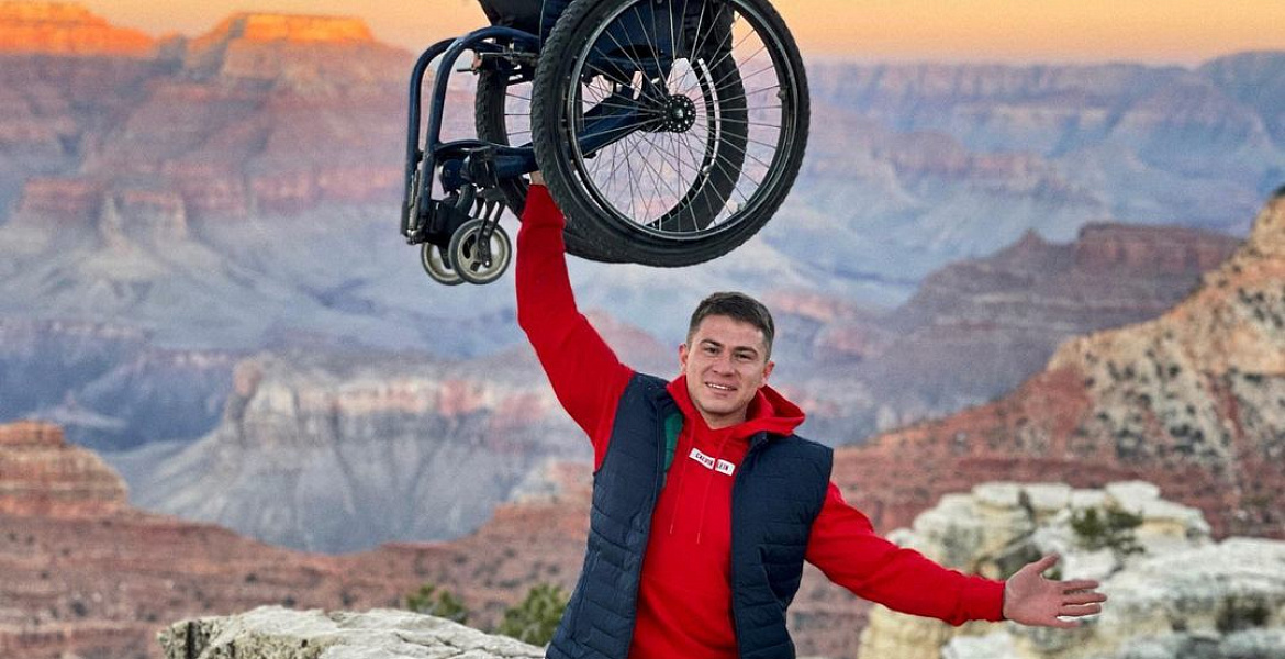 инвалидность ампутация